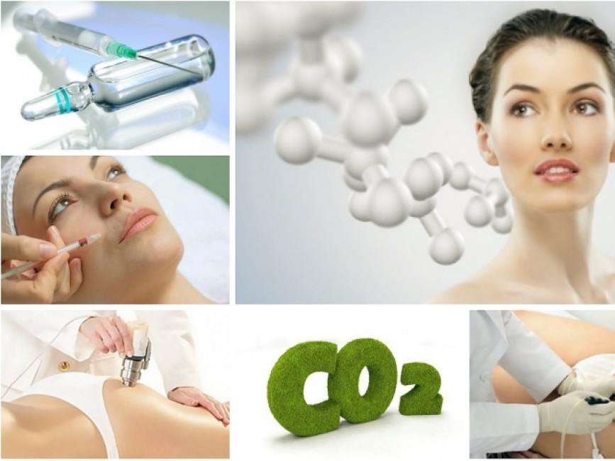 Карбокситерапия