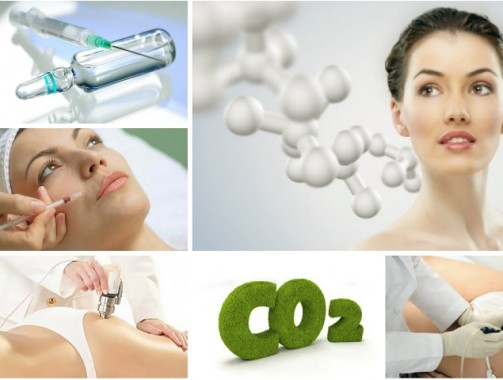 Карбокситерапия